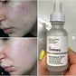 The Ordinary Niacinamide 10% + Zinc 1% – 30ml